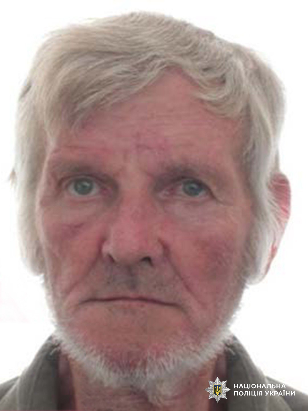 Пішов в ліс і не повернувся: поліція Буковини розшукує безвісти зниклого чоловіка