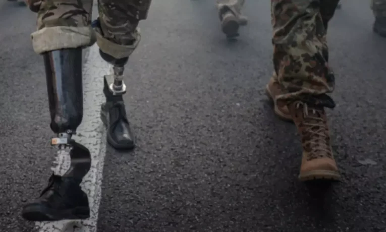 На Буковині розслідують можливе шахрайство під час протезування військових