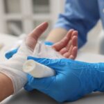 У Чернівцях побільшало опіків під час консервації: лікарі розповіли, як правильно надати першу допомогу